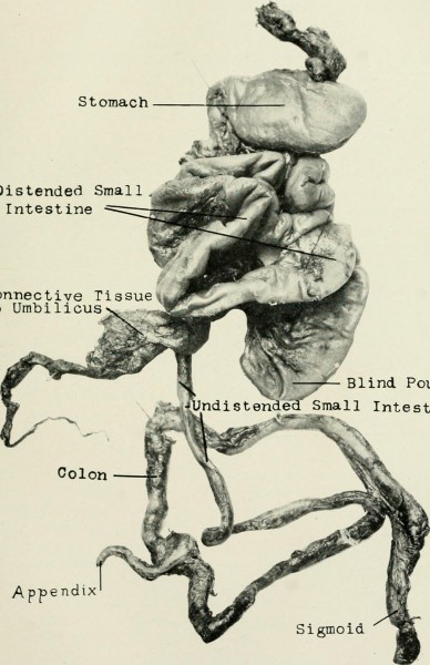 Image from page 108 of "Medical and surgical reports" (1904)